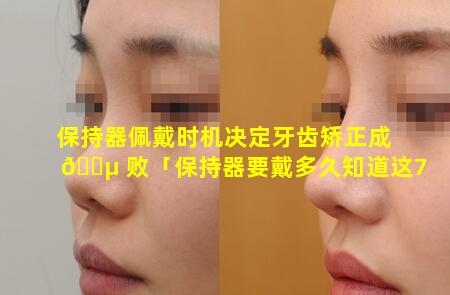 保持器佩戴时机决定牙齿矫正成 🐵 败「保持器要戴多久知道这7件事」